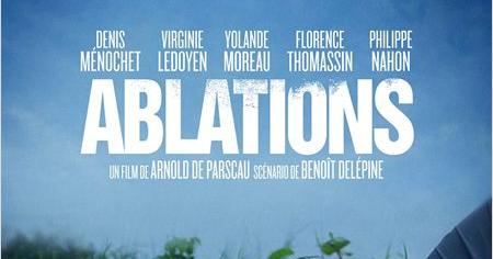 Film ablations sales