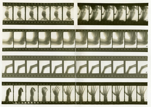 Films radiographiques de Jean Comandon et Lomon, 1911 - Collection Cinémathèque française